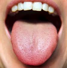gray furry tongue